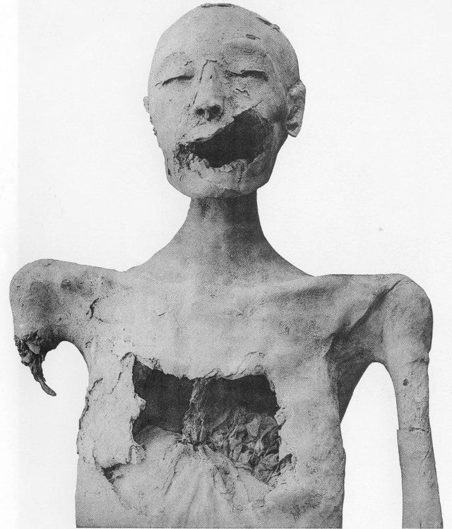 TheYoungerLady-61072-FrontView-PlateXCIX-TheRoyalMummies-1912: Front view of the "Younger Lady Mummy" found in tomb KV35. This image clearly displays the damage thought to be done