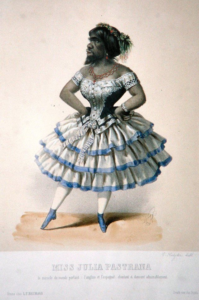Julia Pastrana: Julia Pastrana