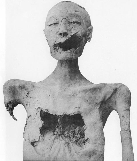 TheYoungerLady-61072-FrontView-PlateXCIX-TheRoyalMummies-1912: Front view of the "Younger Lady Mummy" found in tomb KV35. This image clearly displays the damage thought to be done